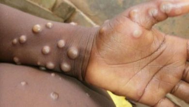 Photo of संयुक्त राज्य अमेरिका में पहली बार बच्चों में हुई  मंकीपाक्स की पहचान, अलर्ट मोड पर है सरकार