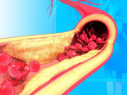 Photo of कोलेस्ट्रॉल कंट्रोल करने के लिए रोजाना खाएं ये चीजें