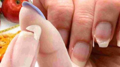 Photo of सर्द‍ियों में बार-बार नाखून क्‍यों टूटते हैं?