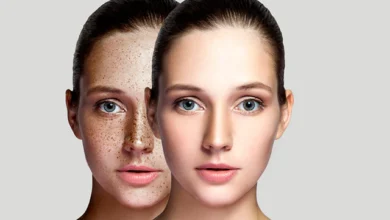Photo of जानिए नेचुरल तरीके से भी दाग-धब्बों को दूर कर ने का तरीका..