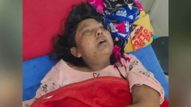 Photo of किडनी गंवा चुकी सुनीता चिकन पॉक्स से पीड़ित हो गई , इतना ही नहीं कमजोर हो रही उनकी आंखों की रोशनी..