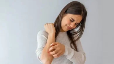 Photo of गर्मियों में इन उपायों को करने से  दाद-खाज और खुजली को दूर किया जा सकता-