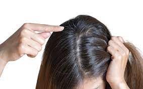 Photo of आप नेचुरल उपाय अपनाकर भी सफेद बालों को कम कर सकते हैं, तो आइए जानें इन असरदार उपायों के बारे में…