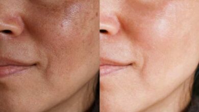 Photo of आदतों के बारे में जानेंगे साथ ही डार्क स्पॉट्स को दूर करने के उपाय भी..