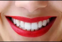 Photo of दांतों को बनाना है मजबूत तो अपनाए ये 4 घरेलू उपाय जो देंगें तुरंत लाभ