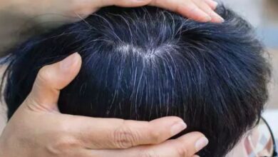 Photo of बच्चों में सफेद होते बालों की समस्या