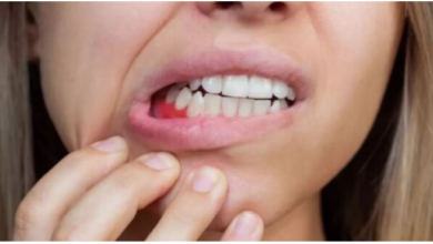 Photo of मसूड़ों से खून आने की समस्या से हैं परेशान, अपनाएं ये आसान टिप्स
