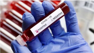 Photo of लंदन से अमृतसर आई 60 साल की महिला कोरोना पॉजिटिव