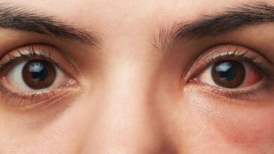 Photo of आपकी लाइफस्टाइल की ये आदतें बन सकती हैं आंखों की दुश्मन