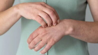 Photo of इन उपायों से पाएं दाद खाज खुजली से राहत