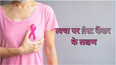 Photo of ब्रेस्ट कैंसर के त्वचा पर नजर आते हैं ये प्रमुख लक्षण