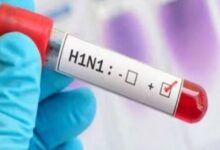 Photo of यूपी में हुई स्वाइन फ्लू की एंट्री; आगरा में एक महिला में मिला Influenza H1N1