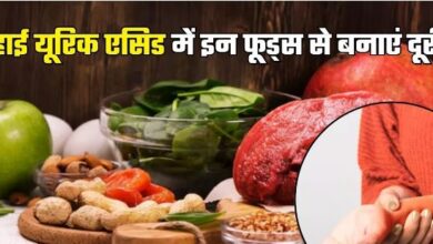 Photo of High Uric Acid में भूलकर भी न खाएं 7 फूड्स