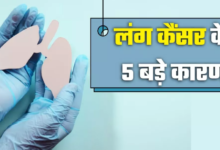 Photo of सिर्फ स्मोकिंग करने वालों की बीमारी नहीं है लंग कैंसर, ये 5 कारण भी हैं जानलेवा
