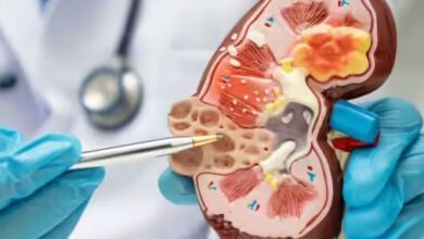 Photo of किडनी डैमेज की शुरुआत में दिखते हैं ये 8 लक्षण
