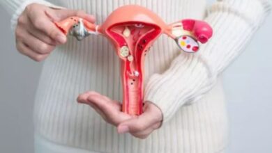 Photo of क्यों जरूरी है PCOS की समय पर पहचान, इन 5 लक्षणों से लगा सकते हैं पता