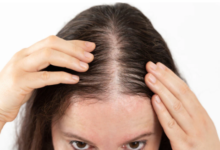 Photo of हेयर फॉल की सबसे बड़ी वजह है प्रोटीन की कमी