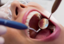 Photo of खराब ओरल हेल्थ कैसे बनती है बड़ी बीमारियों की वजह