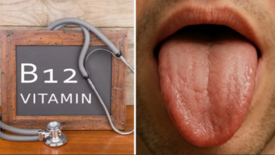 Photo of जीभ पर दिखते हैं विटामिन-B12 की कमी के 3 बड़े संकेत