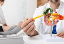 Photo of इन गलतियों की वजह से बढ़ जाता है गालब्लैडर स्टोन का जोखिम