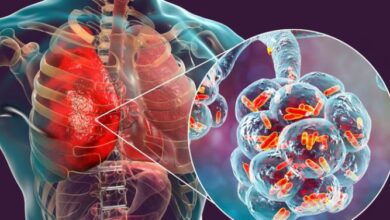 Photo of बुखार मे ऐसे करे निमोनिया के संकेतो की पहचान