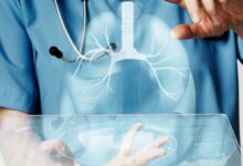 Photo of बच्चों-बुजुर्गों के लिए जानलेवा हो सकती है निमोनिया जाने केसे