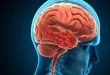 Photo of दिमाग को फेल कर देता है हाई ब्लड प्रेशर जानें केसे