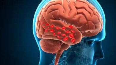 Photo of दिमाग को फेल कर देता है हाई ब्लड प्रेशर जानें केसे