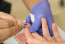 Photo of ऑस्ट्रेलिया की बड़ी खोज, हेपेटाइटिस बी की जांच अब होगी आसान